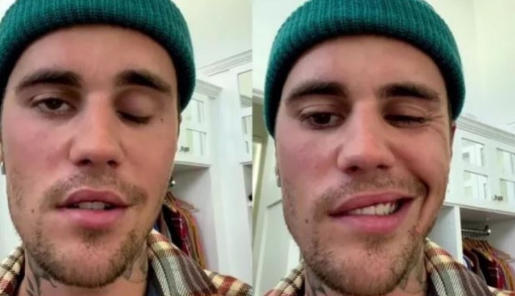 Justin Bieber, Yüz Felci Oldu!