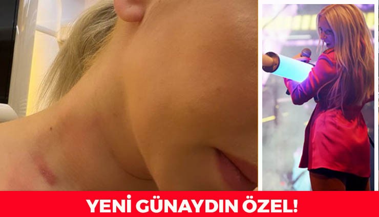 ÖZEL HABER: Ece Seçkin Saldırıya Uğradı!