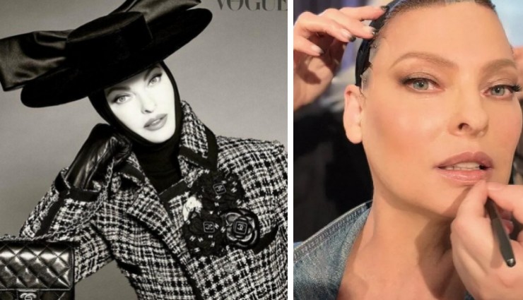 Linda Evangelista Estetik Mağduru Oldu!