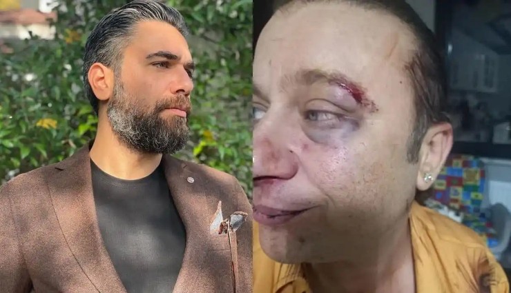 Onur Akay Saldırıya Uğradığını Açıkladı!
